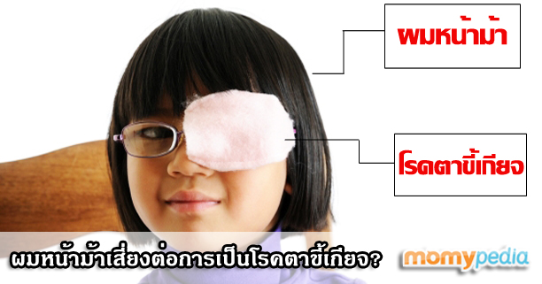 ผมหน้าม้า,สายตาขี้เกียจ,โรคสายตาขี้เกียจ,โรคตาขี้เกียจ,ผมหน้าม้าทำให้เป็นโรคตาขี้เกียจ,ผมหน้าม้าทำให้สายตาขี้เกียจ,โรคเกี่ยวกับดวงตา,เด็กเล็กเป็นโรคตาขี้เกียจ,ลูกเป็นโรคตาขี้เกียจ,โรคตาขี้เกียจคืออะไร,โรคสายตาขี้เกียจคืออะไร,วิธีแก้ไขสายตาขี้เกียจ,ลูก3ขวบเป็นโรคตาขี้เกียจ,ตาเข,ตาเหล่,ตาเอียง ผมหน้าม้า,สายตาขี้เกียจ,โรคสายตาขี้เกียจ,โรคตาขี้เกียจ,ผมหน้าม้าทำให้เป็นโรคตาขี้เกียจ,ผมหน้าม้าทำให้สายตาขี้เกียจ,โรคเกี่ยวกับดวงตา,เด็กเล็กเป็นโรคตาขี้เกียจ,ลูกเป็นโรคตาขี้เกียจ,โรคตาขี้เกียจคืออะไร,โรคสายตาขี้เกียจคืออะไร,วิธีแก้ไขสายตาขี้เกียจ,ลูก3ขวบเป็นโรคตาขี้เกียจ,ตาเข,ตาเหล่,ตาเอียง