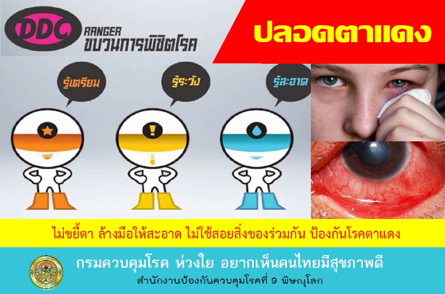 โรคติดต่อ,ตาแดง,โรคตาแดง,โรคภัยไข้เจ็บ,ป่วย,ป้องกันตาแดง,รักษาตาแดง,โรคระบาด,โรคหน้าฝน,ระบาดหน้าฝน โรคติดต่อ,ตาแดง,โรคตาแดง,โรคภัยไข้เจ็บ,ป่วย,ป้องกันตาแดง,รักษาตาแดง,โรคระบาด,โรคหน้าฝน,ระบาดหน้าฝน
