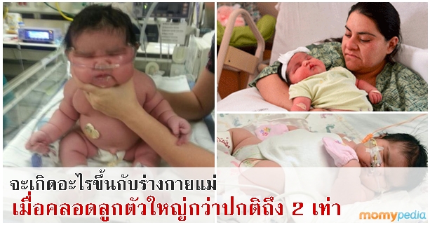 คลอดลูก, คลอดลูกเอง, คลอดลูกตามธรรมชาติ, เบ่งคลอด, คลอดลูกตัวใหญ่, ลูกตัวใหญ่, ลูกตัวโต, เด็กตัวใหญ่, เด็กตัวโต, ทารกตัวใหญ่, ทารกตัวโต, ทารกยักษ์, คลอดลูก, คลอดลูกเอง, คลอดลูกตามธรรมชาติ, เบ่งคลอด, คลอดลูกตัวใหญ่, ลูกตัวใหญ่, ลูกตัวโต, เด็กตัวใหญ่, เด็กตัวโต, ทารกตัวใหญ่, ทารกตัวโต, ทารกยักษ์,