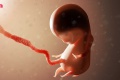จะรู้ได้อย่างไรว่าลูกในท้องไม่โต ทารกในครรภ์มีพัฒนาการผิดปกต ...